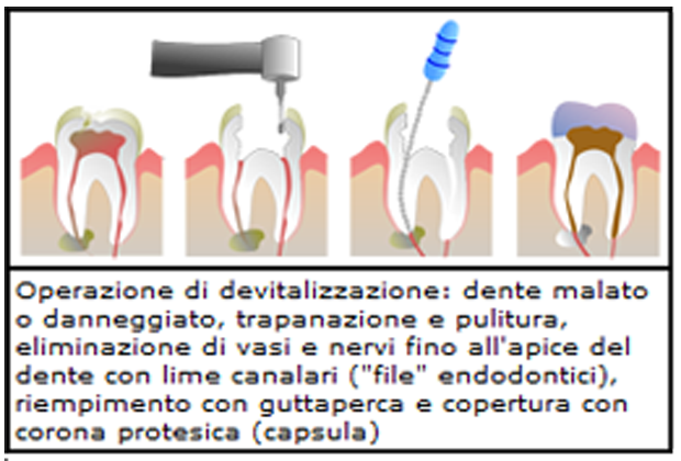 endodonzia